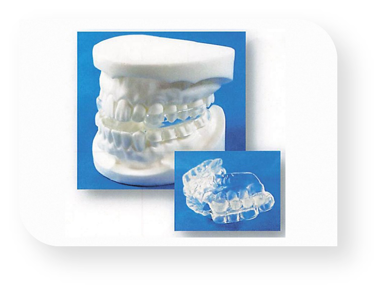 睡眠時無呼吸症